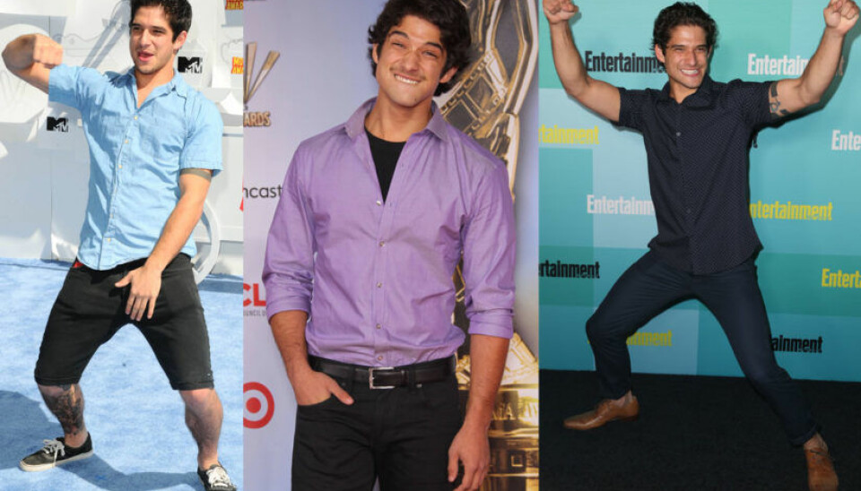 25 gånger Tyler Posey inte kunnat vara seriös på bild