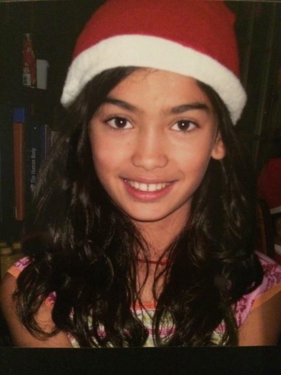 Kelly Gale mobbades i skolan. Idag är hon en världskänd modell. Kelly Gale mobbades i skolan. Idag är hon en världskänd modell.