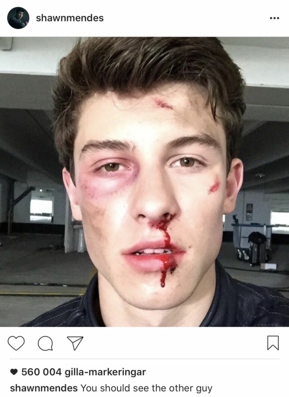 Vilken Shawn Mendes-selfie gillar du mest? Rösta här!