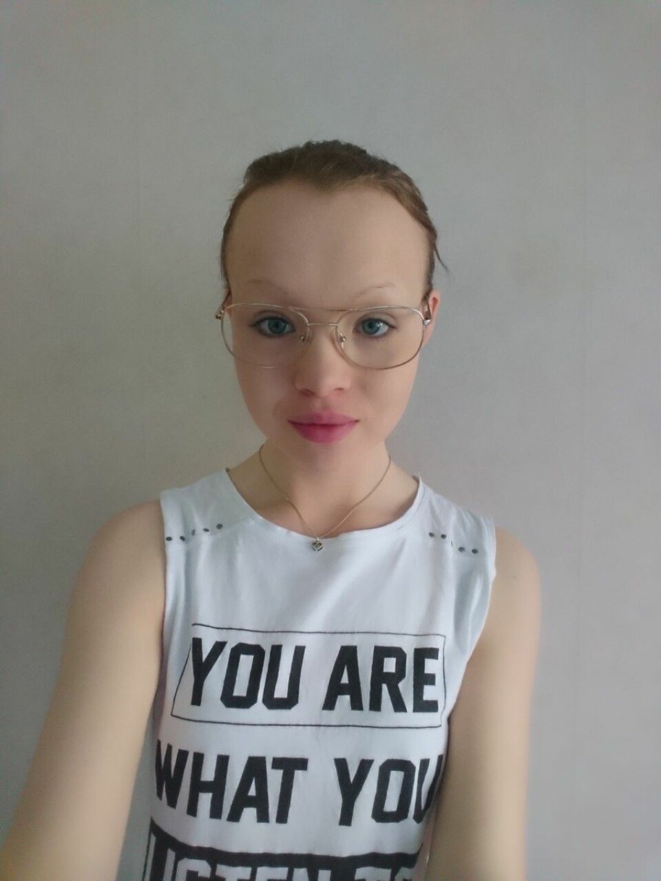 Felicia Fjällberg fick sin diagnos som 12-åring. Nu måste hon lära sig att leva med sjukdomen akalasi. Felicia Fjällberg fick sin diagnos som 12-åring. Nu måste hon lära sig att leva med sjukdomen akalasi.