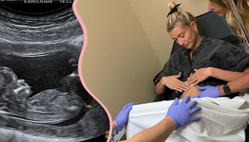 Här är sanningen om Justin och Hailey Biebers bebis