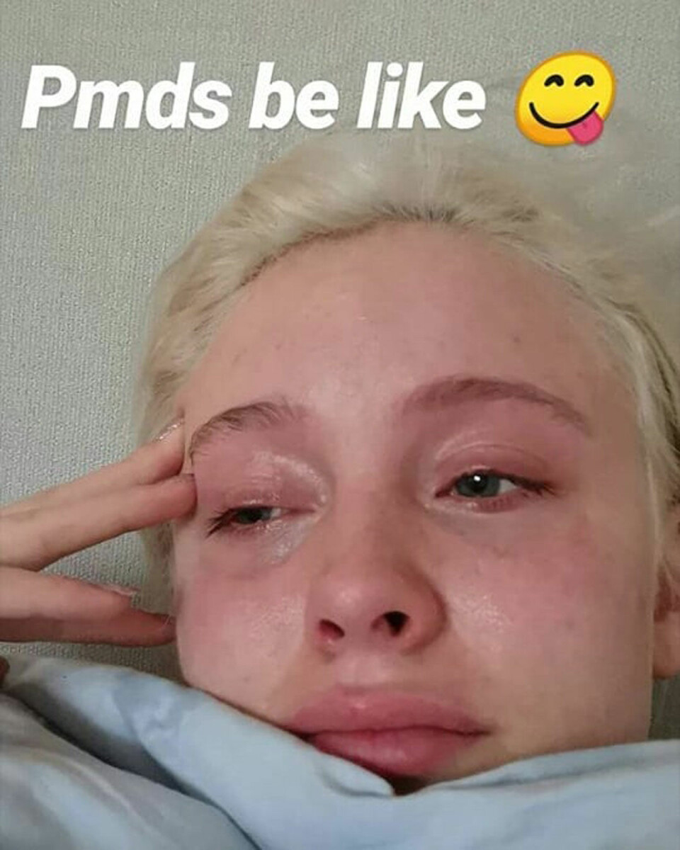 Zara Larsson om sin svåra PMDS: ”Förstör mig”