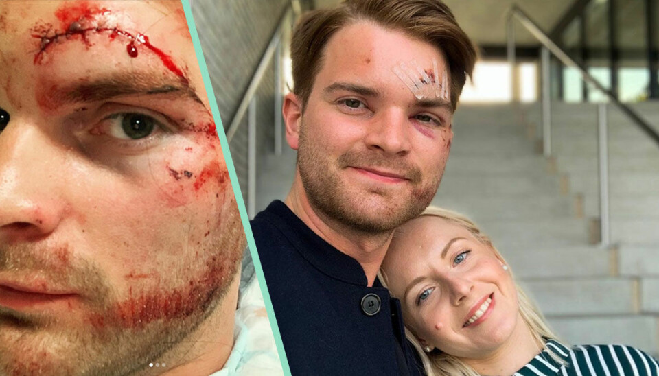 Youtubern Lucas Simonsson i elscooterolycka: 'Var försiktiga'