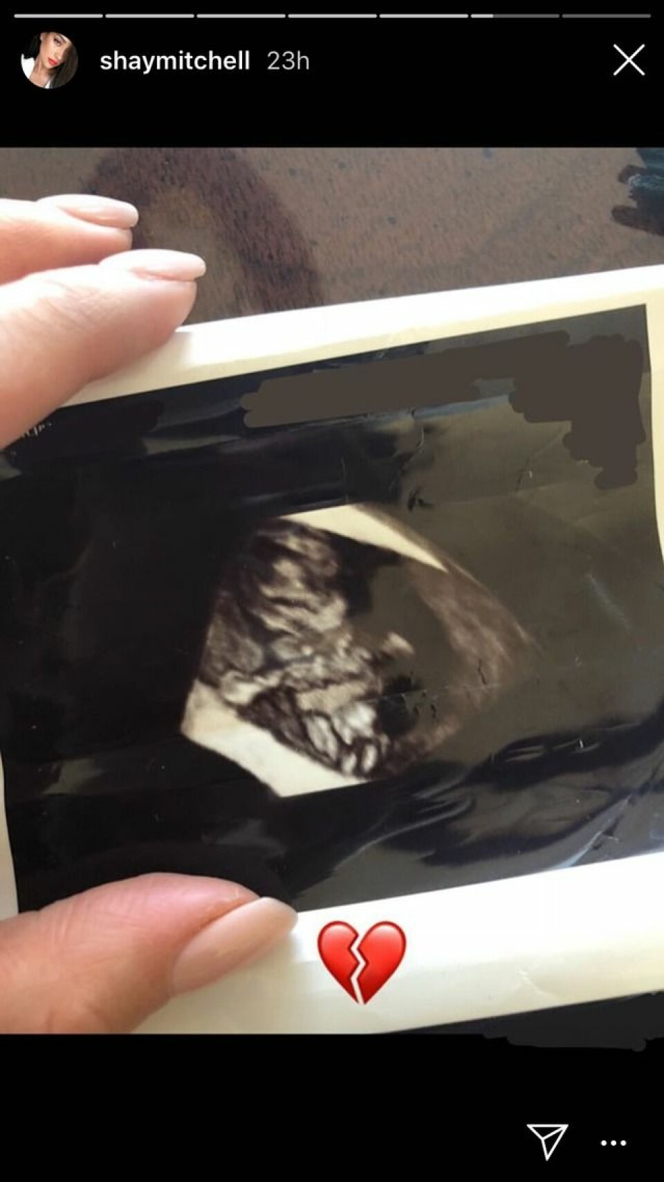 Hurra! PLL-stjärnan Shay Mitchell är gravid